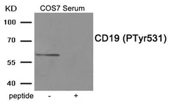 Anti-CD19 (phospho Tyr531) antibody used in Western Blot (WB). GTX55384