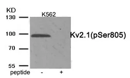Anti-Kv2.1 (phospho Ser805) antibody used in Western Blot (WB). GTX55387