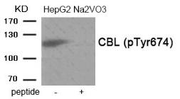 Anti-CBL (phospho Tyr674) antibody used in Western Blot (WB). GTX55390
