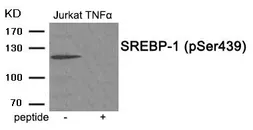 Anti-SREBP1 (phospho Ser439) antibody used in Western Blot (WB). GTX55392