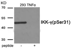 Anti-IKK gamma (phospho Ser31) antibody used in Western Blot (WB). GTX55396