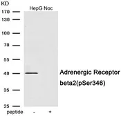 Anti-beta 2 Adrenergic Receptor (phospho Ser346) antibody used in Western Blot (WB). GTX55398