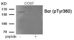 Anti-Bcr (phospho Tyr360) antibody used in Western Blot (WB). GTX55399