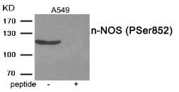 Anti-nNOS (phospho Ser852) antibody used in Western Blot (WB). GTX55400
