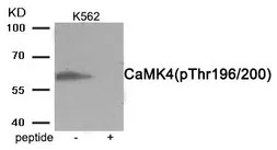 Anti-CaMKIV (phospho Thr200) antibody used in Western Blot (WB). GTX55402