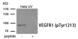Anti-VEGF Receptor 1 (phospho Tyr1213) antibody used in Western Blot (WB). GTX55404