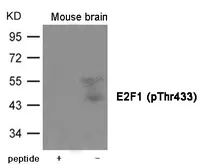 Anti-E2F1 (phospho Thr433) antibody used in Western Blot (WB). GTX55412