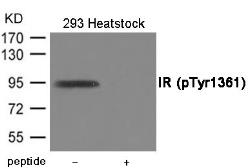 Anti-Insulin Receptor (phospho Tyr1322) antibody used in Western Blot (WB). GTX55415