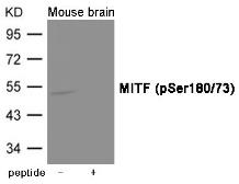 Anti-MITF (phospho Ser180/73) antibody used in Western Blot (WB). GTX55417