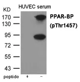 Anti-MED1 (phospho Thr1457) antibody used in Western Blot (WB). GTX55418