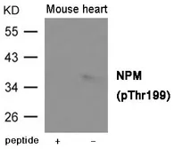 Anti-Nucleophosmin (phospho Thr199) antibody used in Western Blot (WB). GTX55419