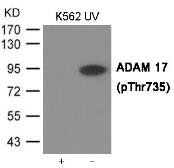 Anti-ADAM17 (phospho Thr735) antibody used in Western Blot (WB). GTX55420