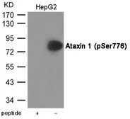 Anti-Ataxin 1 (phospho Ser776) antibody used in Western Blot (WB). GTX55421