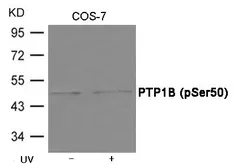 Anti-PTP1B (phospho Ser50) antibody used in Western Blot (WB). GTX55423