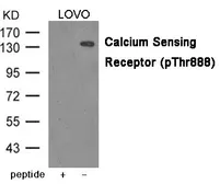 Anti-Calcium Sensing Receptor (phospho Thr888) antibody used in Western Blot (WB). GTX55424
