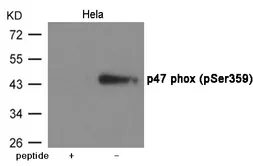 Anti-NCF1 (phospho Ser359) antibody used in Western Blot (WB). GTX55429