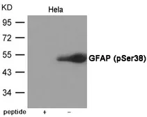 Anti-GFAP (phospho Ser38) antibody used in Western Blot (WB). GTX55430