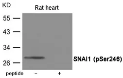 Anti-SNAI1 (phospho Ser246) antibody used in Western Blot (WB). GTX55431