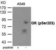 Anti-Glucocorticoid Receptor (phospho Ser203) antibody used in Western Blot (WB). GTX55432