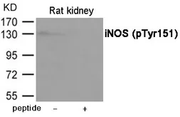 Anti-iNOS (phospho Tyr151) antibody used in Western Blot (WB). GTX55433