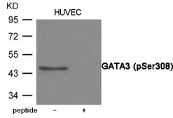 Anti-GATA3 (phospho Ser308) antibody used in Western Blot (WB). GTX55434