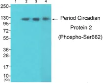 Anti-PER2 (phospho Ser662) antibody used in Western Blot (WB). GTX55438