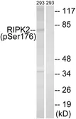 Anti-RIP2 (phospho Ser176) antibody used in Western Blot (WB). GTX55439