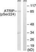 Anti-ATRIP (phospho Ser224) antibody used in Western Blot (WB). GTX55441