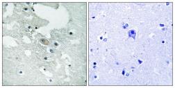 Anti-BLNK (phospho Tyr84) antibody used in IHC (Paraffin sections) (IHC-P). GTX55443