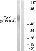Anti-TAK1 (phospho Thr184) antibody used in Western Blot (WB). GTX55449