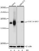 Anti-SMC1 (phospho Ser957) antibody used in Western Blot (WB). GTX55474