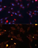 Anti-ADAMTS4 antibody used in Immunocytochemistry/ Immunofluorescence (ICC/IF). GTX55492