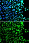 Anti-AEBP2 antibody used in Immunocytochemistry/ Immunofluorescence (ICC/IF). GTX55495