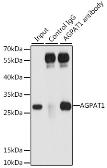 Anti-AGPAT1 antibody used in Immunoprecipitation (IP). GTX55496