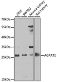 Anti-AGPAT1 antibody used in Western Blot (WB). GTX55496