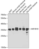 Anti-AKR1B10 antibody used in Western Blot (WB). GTX55498