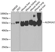 Anti-ALDH1A2 antibody used in Western Blot (WB). GTX55501