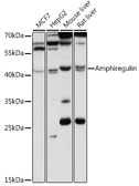 Anti-Amphiregulin antibody used in Western Blot (WB). GTX55511