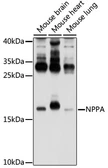 Anti-ANP antibody used in Western Blot (WB). GTX55513