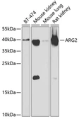 Anti-ARG2 antibody used in Western Blot (WB). GTX55516