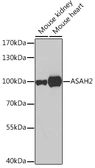 Anti-ASAH2 antibody used in Western Blot (WB). GTX55519