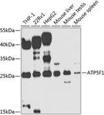 Anti-ATP synthase B1 antibody used in Western Blot (WB). GTX55525