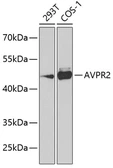Anti-AVPR2 antibody used in Western Blot (WB). GTX55528