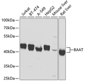 Anti-BAAT antibody used in Western Blot (WB). GTX55529