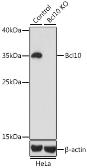 Anti-BCL10 antibody used in Western Blot (WB). GTX55533