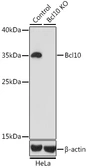 Anti-BCL10 antibody used in Western Blot (WB). GTX55533
