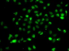 Anti-BCL6 antibody used in Immunocytochemistry/ Immunofluorescence (ICC/IF). GTX55534
