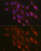 Anti-beta-TrCP antibody used in Immunocytochemistry/ Immunofluorescence (ICC/IF). GTX55536