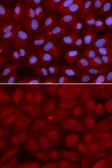 Anti-BIN1 antibody used in Immunocytochemistry/ Immunofluorescence (ICC/IF). GTX55538