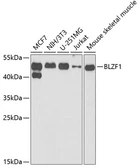 Anti-BLZF1 antibody used in Western Blot (WB). GTX55539